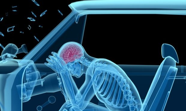 What A Car Crash Does To Your Body (Part One)_istock